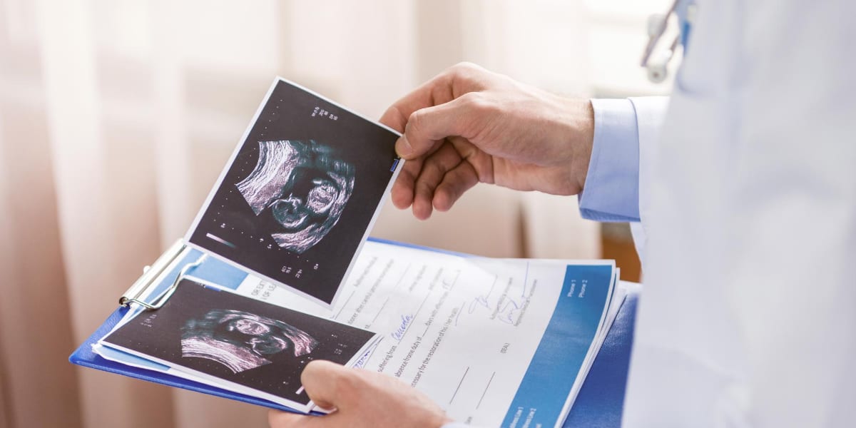 pregnancy scan prints
