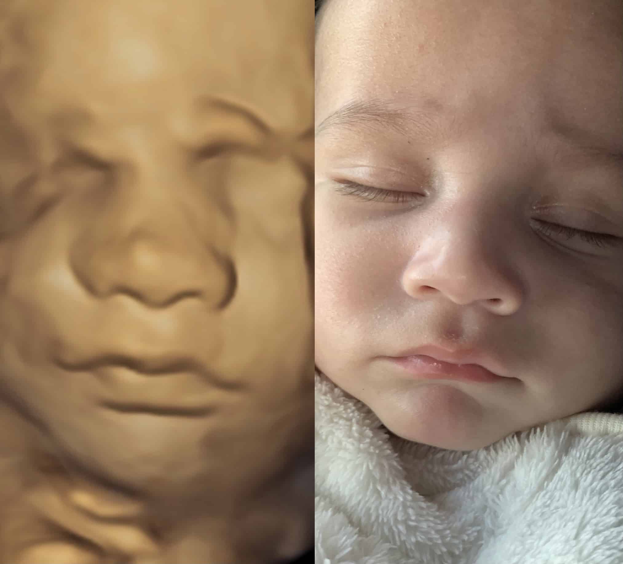 3d scans and 4d scans